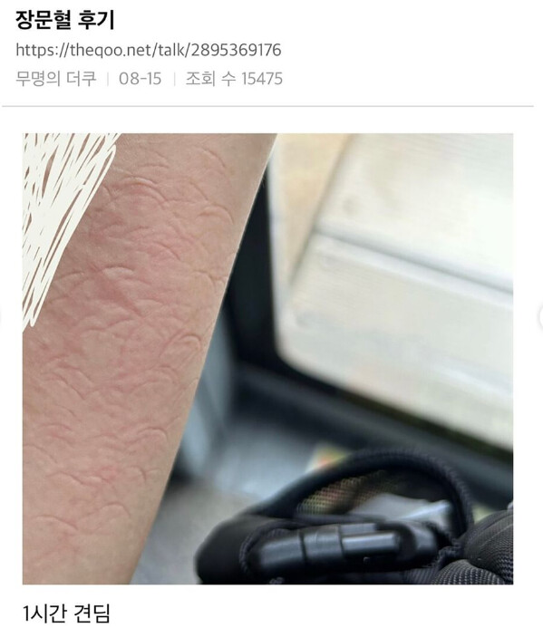 인터넷커뮤니티에 게재된 장문혈 후기.(사진=인터넷커뮤니티)/서울와이어