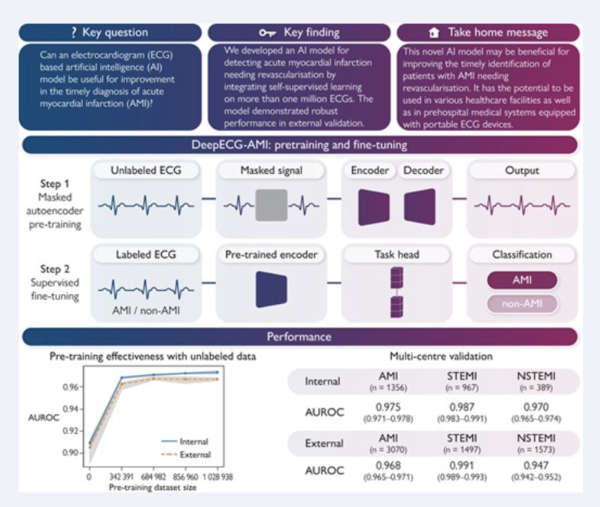 VUNO Med-DeepECG AMI 알고리즘 기반 연구.(사진=뷰노)