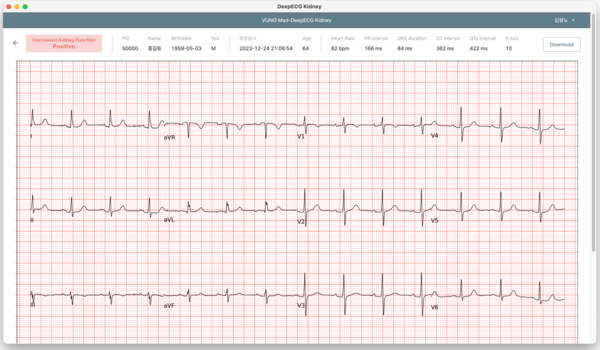 DeepECG Kidney 운영화면 예시.(사진=뷰노)