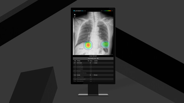 Lunit INSIGHT CXR.(사진=루닛)